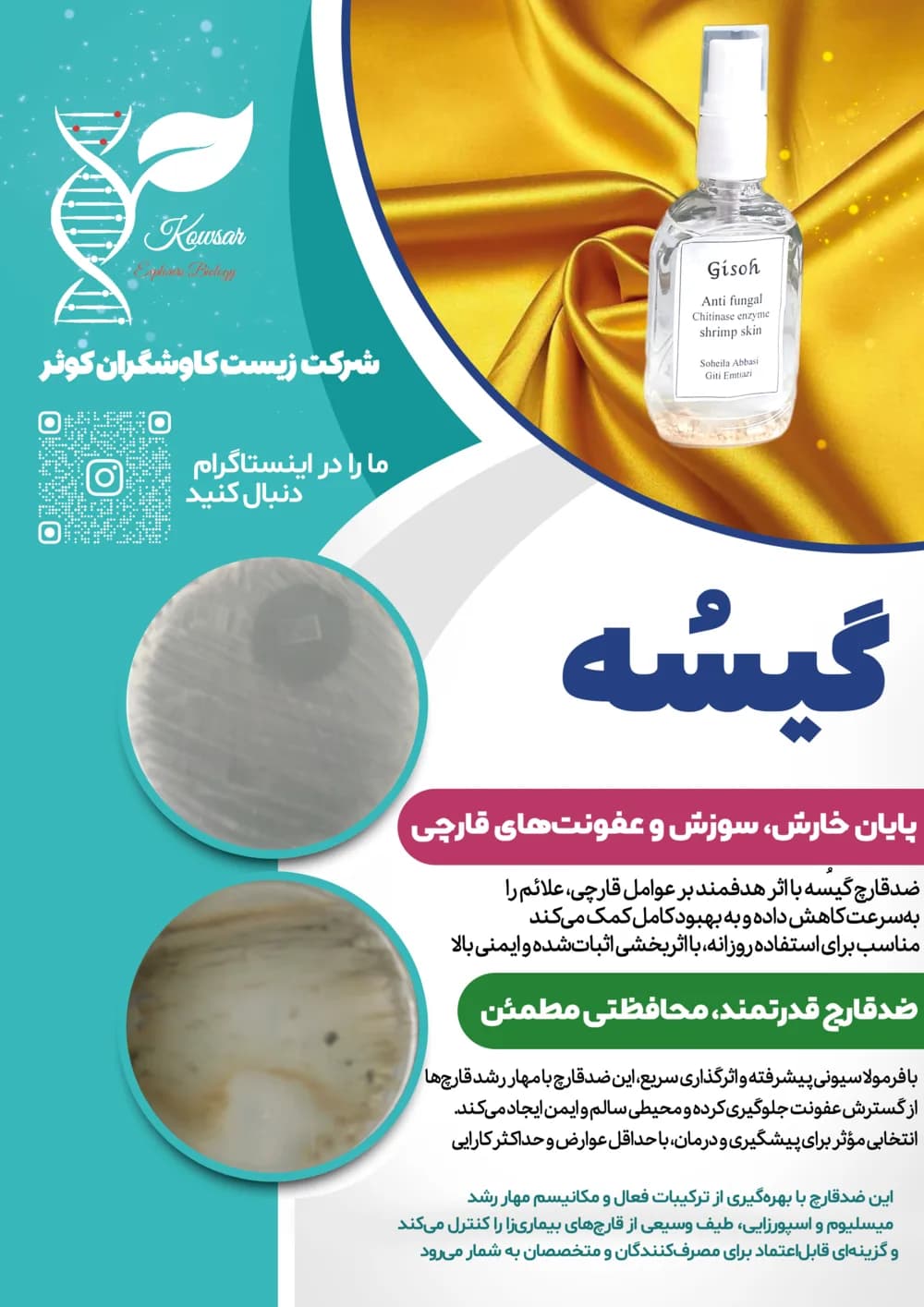 پوستر معرفی گیسه